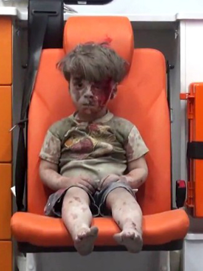 Omran Daqneesh