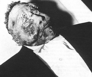 Emmett Till after the lynching, 1955.