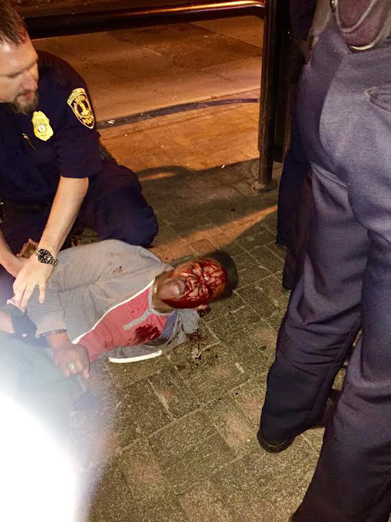 The Pig Assault on Martese Johnson