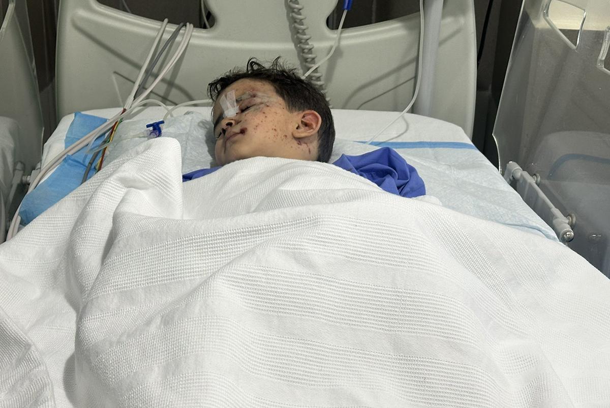 Injured child injured by Israeli airstrike in Bekaa Valley, Lebanon, October 28, 2024.