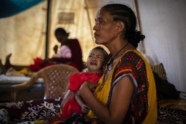Mother holds her malnourished child in Ethiopia where thousands face famine.