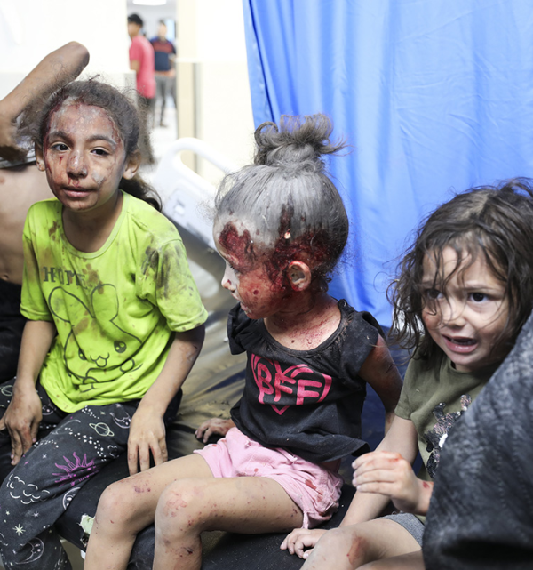 Palestinian children wounded by Israeli strikes in Gaza City, October 11, 2023.