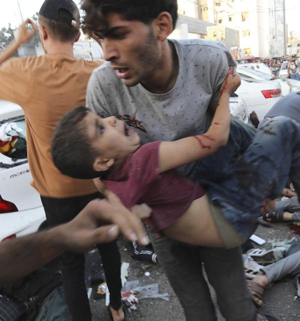 Boy injured from Israeli airstrike outside the entrance of the al-Shifa hospital in Gaza City, November 3, 2023.