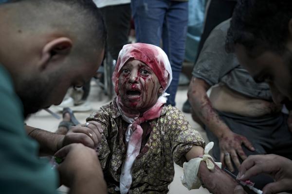 Palestinian child wounded in the Israeli bombardment of the Gaza Strip at a hospital in Deir al-Balah, October 10, 2024. 