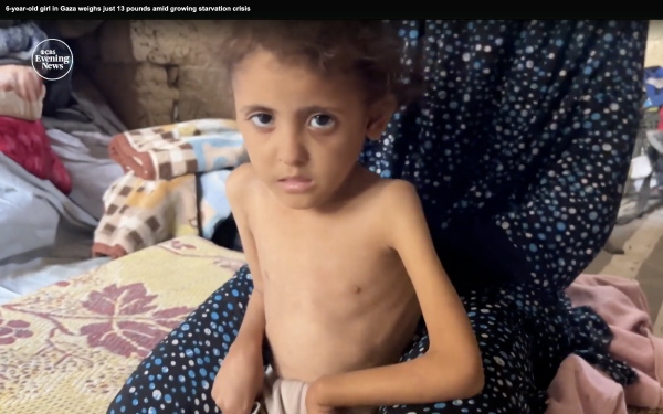 Six-year-old Najwa Hussein Hajjaj, who has dropped more than 40% of her body weight, weighing 21 pounds.