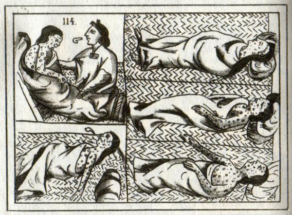 Aztec drawing from 1500s of smallpox victims.