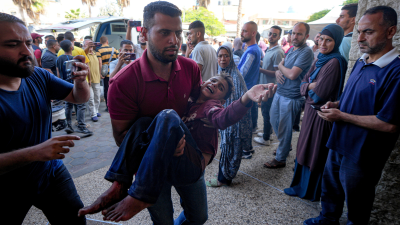Palestinian child injured by Israeli airstrike in Deir al Balah, Gaza Strip, October 10, 2024.