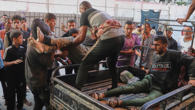Palestinians who were injured during a food distribution at a center run by the Gaza Humanitarian Foundation, a U.S.-backed organization approved by Israel, July 18, 2025.