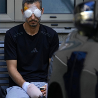 Lebanon: man being treated for injuries when hand-held device exploded, September 20, 2024.